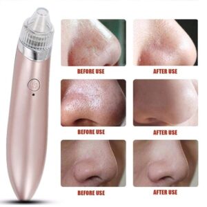 Multifunctional Cleaning Instrument Black Head Extractor Face Skin Care Tools